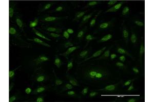 Immunofluorescence of monoclonal antibody to CSE1L on HeLa cell. (Exportin 2 Antikörper  (AA 872-971))