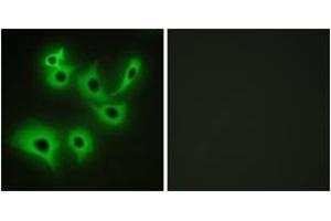 Immunofluorescence analysis of A549 cells, using CDH4 Antibody. (Cadherin 4 Antikörper  (AA 731-780))