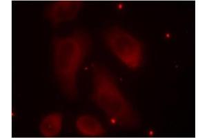Image no. 3 for anti-LIM Domain Kinase 1 (LIMK1) (pThr508) antibody (ABIN196830) (LIM Domain Kinase 1 Antikörper  (pThr508))