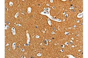 The image on the left is immunohistochemistry of paraffin-embedded Human brain tissue using ABIN7128257(ADD2 Antibody) at dilution 1/15, on the right is treated with fusion protein.