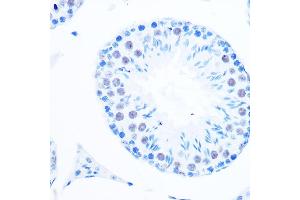Immunohistochemistry of paraffin-embedded mouse testis using DNA Polymerase beta Rabbit mAb (ABIN7269456) at dilution of 1:100 (40x lens). (POLB Antikörper)