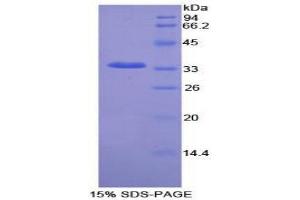 SDS-PAGE (SDS) image for NIMA (Never in Mitosis Gene A)-Related Kinase 2 (NEK2) (AA 137-400) protein (His tag) (ABIN1878467)