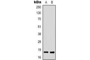 Western blot analysis of FAT10 expression in K562 (A), HEK293T (B) whole cell lysates. (UBD Antikörper)