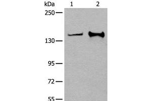 Western blot analysis of Hela and A172 cell lysates using CAPN15 Polyclonal Antibody at dilution of 1:400 (Calpain 15/SOLH Antikörper)