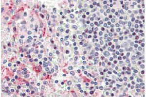 Human Spleen (formalin-fixed, paraffin-embedded) stained with HPSE antibody ABIN337167 at 5 ug/ml followed by biotinylated goat anti-rabbit IgG secondary antibody ABIN481713, alkaline phosphatase-streptavidin and chromogen. (HPSE Antikörper)