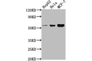Western Blot Positive WB detected in: HepG2 whole cell lysate, Hela whole cell lysate, MCF-7 whole cell lysate All lanes: PRAMEF18 antibody at 1:2000 Secondary Goat polyclonal to rabbit IgG at 1/50000 dilution Predicted band size: 56 kDa Observed band size: 56 kDa (PRAMEF18 Antikörper  (AA 1-257))