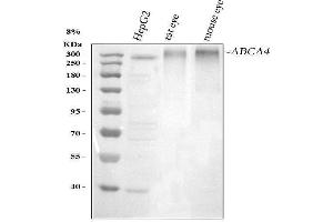 anti-ATP-Binding Cassette, Sub-Family A (ABC1), Member 4 (ABCA4) (AA 1890-1927), (C-Term) antibody