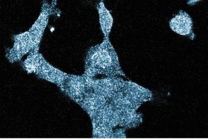 Immunofluorescence staining of A431cells (Human epithelial carcinoma, ATCC CRL-1555) with the mouse anti-GIT1 antibody. (GIT1 Antikörper  (AA 664-770))