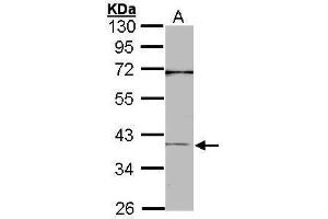 WB Image Sample (30 ug of whole cell lysate) A: A431 , 10% SDS PAGE antibody diluted at 1:1000 (CEBPB Antikörper  (N-Term))