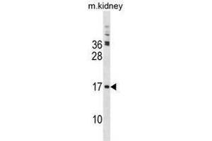 TSC22D3 Antibody (Center) western blot analysis in mouse kidney tissue lysates (35 µg/lane).