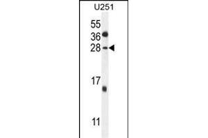 GGTLC2 Antikörper  (AA 127-154)