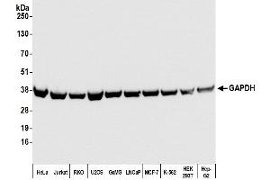 Western Blotting (WB) image for anti-Glyceraldehyde-3-Phosphate Dehydrogenase (GAPDH) (AA 225-275) antibody (ABIN7449428)