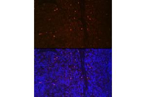 Immunofluorescence (IF) image for anti-Runt-Related Transcription Factor 2 (RUNX2) (AA 242-521) antibody (ABIN3016834)