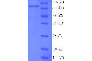 SDS-PAGE (SDS) image for E3 ubiquitin-protein ligase RAD18 (RAD18) (AA 1-495), (full length) protein (His-SUMO Tag) (ABIN4975827) (RAD18 Protein (AA 1-495, full length) (His-SUMO Tag))