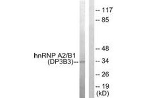 Western Blotting (WB) image for anti-Heterogeneous Nuclear Ribonucleoprotein A2/B1 (HNRNPA2B1) (AA 1-50) antibody (ABIN2889424) (HNRNPA2B1 Antikörper  (AA 1-50))