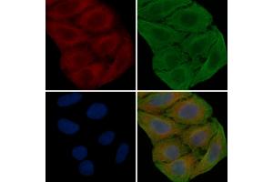 ABIN6259956 and ABIN6276843 staining Hela cells(30 min of UV treatment) by IF/ICC. (Annexin V Antikörper  (C-Term))