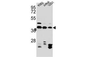 Western blot analysis of HNRNPC Antibody (C-term) in Jurkat,K562,U251 cell line lysates (35ug/lane). (HNRNPC Antikörper  (C-Term))