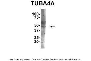 IP Suggested Anti-TUBA4A Antibody Positive Control: NT2 CELL/BRAIN TISSUE (TUBA4A Antikörper  (Middle Region))