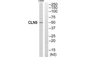 Western Blotting (WB) image for anti-Ceroid-Lipofuscinosis, Neuronal 5 (CLN5) (Internal Region) antibody (ABIN1851078) (CLN5 Antikörper  (Internal Region))