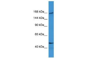 WB Suggested Anti-BTBD12 Antibody Titration: 0. (BTBD12 Antikörper  (N-Term))
