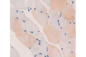 IHC-P analysis of Mouse Tissue, with DAB staining. (TNNT1 Antikörper  (AA 1-261))