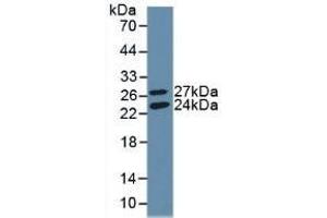 Detection of Recombinant GSS, Human using Polyclonal Antibody to Glutathione Synthetase (GSS) (Glutathione Synthetase Antikörper  (AA 268-474))