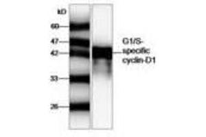 Image no. 1 for anti-Cyclin D1 (CCND1) antibody (ABIN791463) (Cyclin D1 Antikörper)