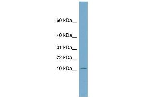 WB Suggested Anti-NOLA3 Antibody Titration: 0. (Nop10 Antikörper  (Middle Region))
