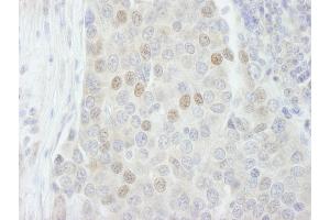 Immunohistochemistry (IHC) image for anti-RNA Binding Motif Protein 27 (RBM27) (AA 700-750) antibody (ABIN7448764) (RBM27 Antikörper  (AA 700-750))