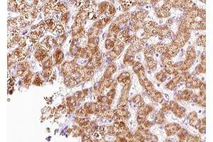 ABIN6268827 at 1/100 staining human liver tissue sections by IHC-P. (CXCR4 Antikörper  (C-Term))