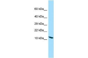 Western Blotting (WB) image for anti-Protein Phosphatase 1, Regulatory (Inhibitor) Subunit 14D (PPP1R14D) (N-Term) antibody (ABIN2790678)