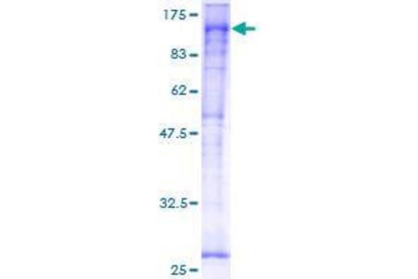 YY1AP1 Protein (AA 1-739) (GST tag)