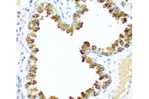Immunohistochemistry (Paraffin-embedded Sections) (IHC (p)) image for anti-Neuregulin 4 (NRG4) antibody (ABIN7260591)