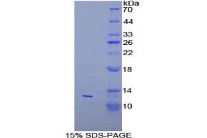 SDS-PAGE analysis of Human PEX2 Protein. (PEX2 Protein)