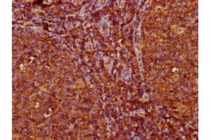 IHC image of ABIN7156094 diluted at 1:200 and staining in paraffin-embedded human tonsil tissue performed on a Leica BondTM system. (IGKC Antikörper  (AA 1-107))