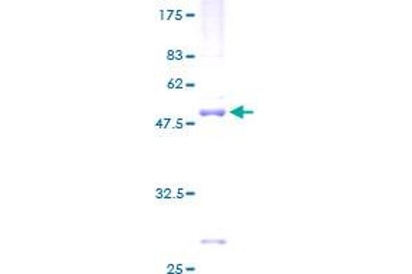 SEC22B Protein (AA 1-215) (GST tag)