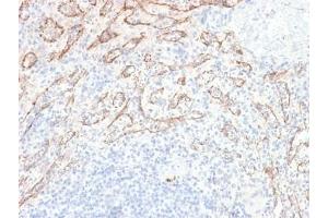Immunohistochemistry (IHC) image for anti-Tumor Necrosis Factor (Ligand) Superfamily, Member 15 (TNFSF15) antibody (ABIN5708010)