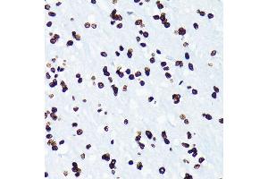 Immunohistochemistry (IHC) image for anti-Histone H4 (acLys5) antibody (ABIN7267743)