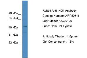 WB Suggested Anti-ING1  Antibody Titration: 0. (ING1 Antikörper  (N-Term))