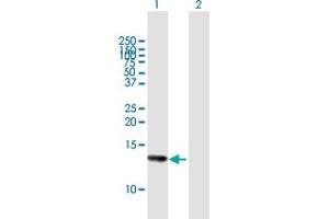 Western Blot analysis of HCP5 expression in transfected 293T cell line by HCP5 MaxPab polyclonal antibody. (HCP5 Antikörper  (AA 1-132))