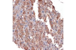 Immunohistochemistry of paraffin-embedded human liver using Apolipoprotein C3 Rabbit mAb (ABIN7265640) at dilution of 1:100 (40x lens). (APOC3 Antikörper)