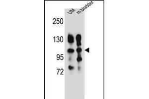 ITGA5 Antibody (Center) (ABIN656138 and ABIN2845477) western blot analysis in human uterine tumor and mouse bladder tissue lysates (35 μg/lane). (ITGA5 Antikörper  (AA 575-602))