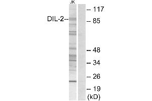 Immunohistochemistry analysis of paraffin-embedded human brain tissue using DIL-2 antibody.