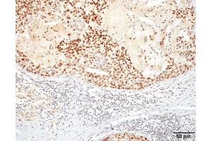 Immunohistochemistry analysis using Rat Anti-HSF1 Monoclonal Antibody, Clone 10H4 . (HSF1 Antikörper  (Atto 390))
