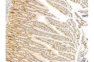 ABIN6265564 and ABIN6273020 at 1/100 staining Rat colon tissue by IHC-P. (TIA1 Antikörper  (Internal Region))