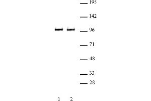 BRD3 antibody (pAb) tested by Western blot. (BRD3 Antikörper  (C-Term))