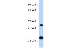SLC25A35 antibody used at 1 ug/ml to detect target protein. (SLC25A35 Antikörper  (N-Term))