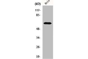 Western Blot analysis of HeLa cells using KOX11 Polyclonal Antibody (ZNF18 Antikörper  (Internal Region))