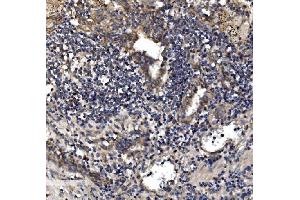 IHC analysis of Astrin/Deepest/SPAG5 using anti-Astrin/Deepest/SPAG5 antibody (ABIN7602399). (SPAG5 Antikörper  (AA 738-1193))