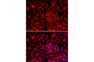 Immunofluorescence analysis of U2OS cells using ILF2 antibody (ABIN6290505). (ILF2 Antikörper)